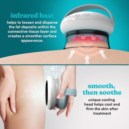 Anti-Cellulite Body Massager with Infrared & 3 Intensities – Multi-Head Suction Massage Device for Slimming & Pain Relief